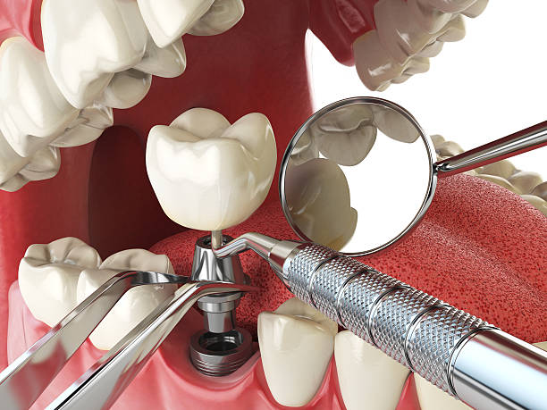 Best Cracked Tooth Emergency Dentist  in Greenwood Village, CO
